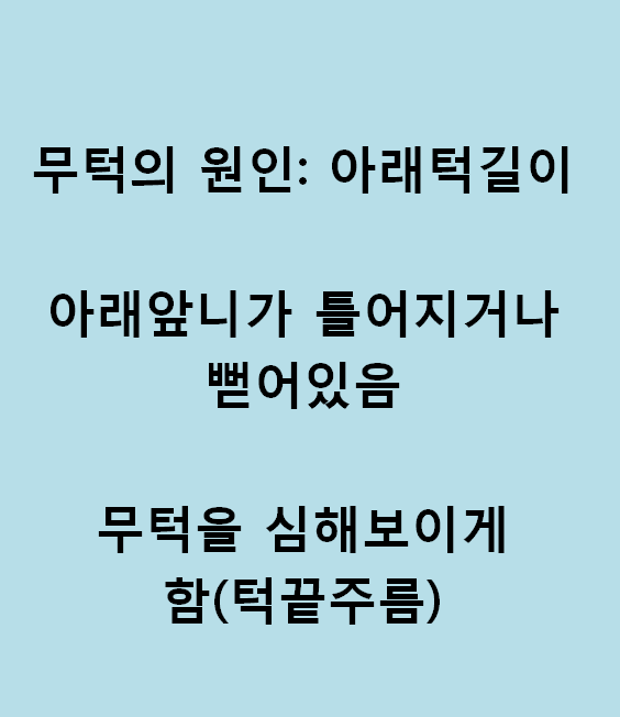 무턱교정전후 이런 분들이 성공! 관련 이미지 6