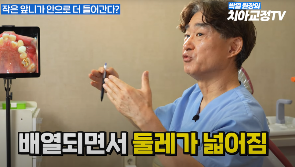 강남역 교정치과 :: 앞니 교정 시작 전에 꼭 알아야 할 한 가지 사실! 관련 이미지 8