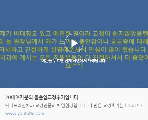 [치아교정후기] 치아교정을 위해 충치치료를 하고, 4개의 치아를 발치했습니다! 관련 이미지 1