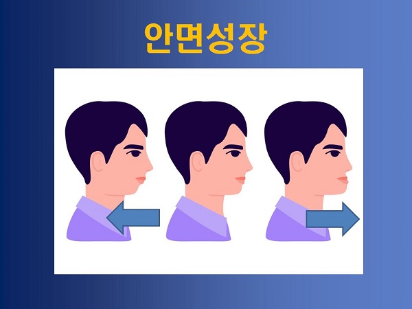 성장기 부정교합 방치했을때의 부작용! 관련 이미지 4