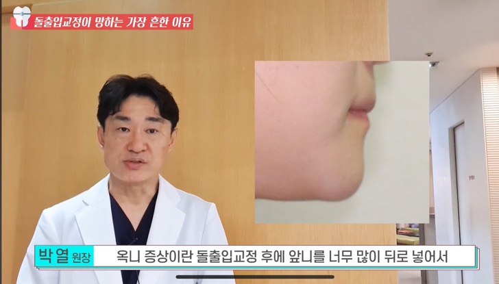 돌출입 교정치과 옥니 돌출입 치아 교정 왜 망할까? 관련 이미지 6