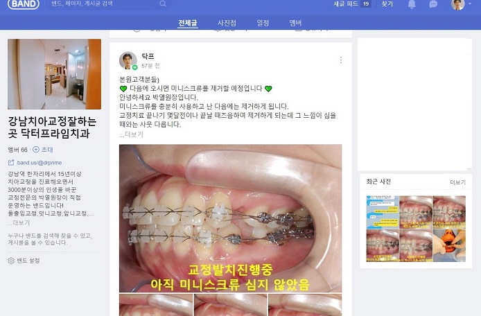 무턱수술했나요? 아니요, 무턱교정만 했어요! 관련 이미지 10