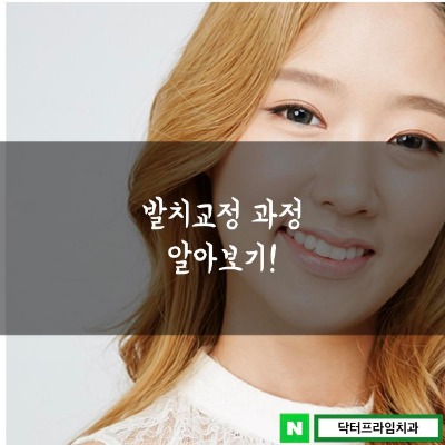 돌출입 교정 중 발치교정 과정 알아보기! 관련 이미지 1