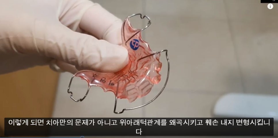 [치아교정] 소아교정=1차교정=턱교정. 비슷한 개념입니다 관련 이미지 3