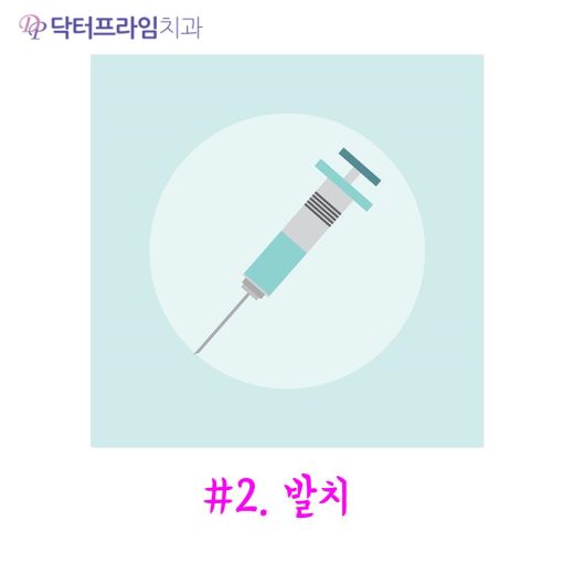 대학생교정 왜 유리한가, 20대 치아교정 체크포인트 관련 이미지 5