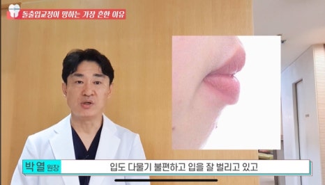 돌출입 교정치과 옥니 돌출입 치아 교정 왜 망할까? 관련 이미지 12