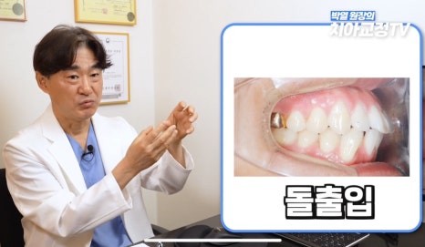 닥터프라임치과 성인 치아 교정 장점은? 관련 이미지 19