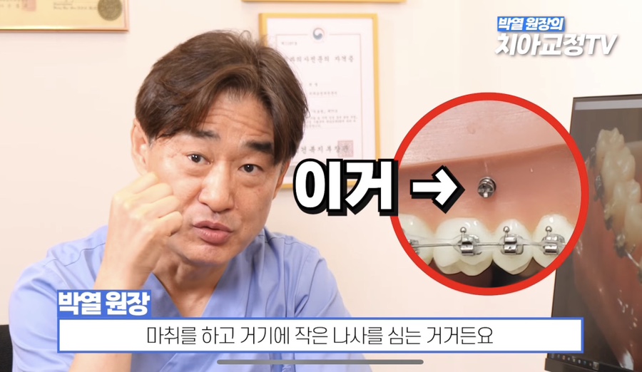 Worried About Orthodontic Pain? The Most Painful Moments During Orthodontic Treatment: Top 7 Pain Ranking image 10