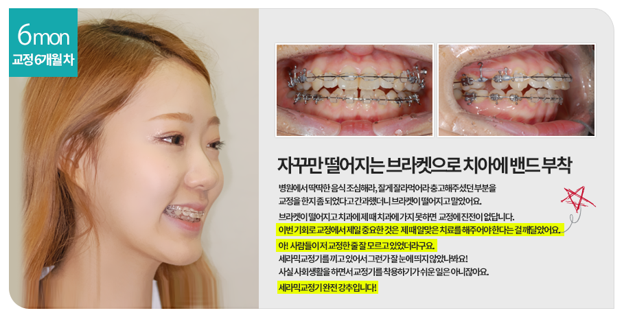 교정첫방문 두근두근, 콩닥콩닥 관련 이미지 4