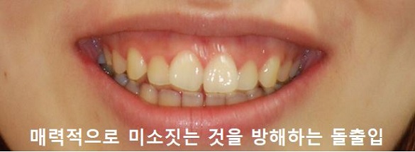 매력적으로 미소짓는 법! 관련 이미지 6