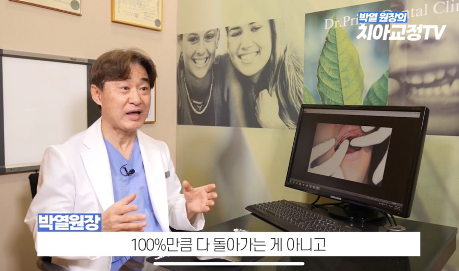 How to Use Retainers After Orthodontic Treatment, Explained by an Orthodontic Specialist with 25 Years of Experience image 22