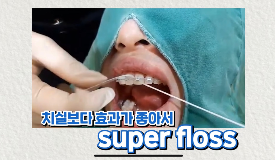 교정기 치아 교정 음식물 끼임 어떻게 해결해야할까? 관련 이미지 8