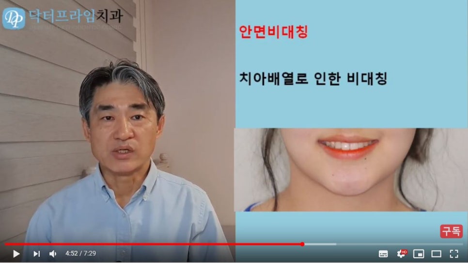 얼굴이 이뻐지는 치아교정! (덧니, 비대칭, 돌출입) 관련 이미지 12