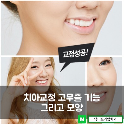 치아교정 고무줄 기능 그리고 모양 관련 이미지 1