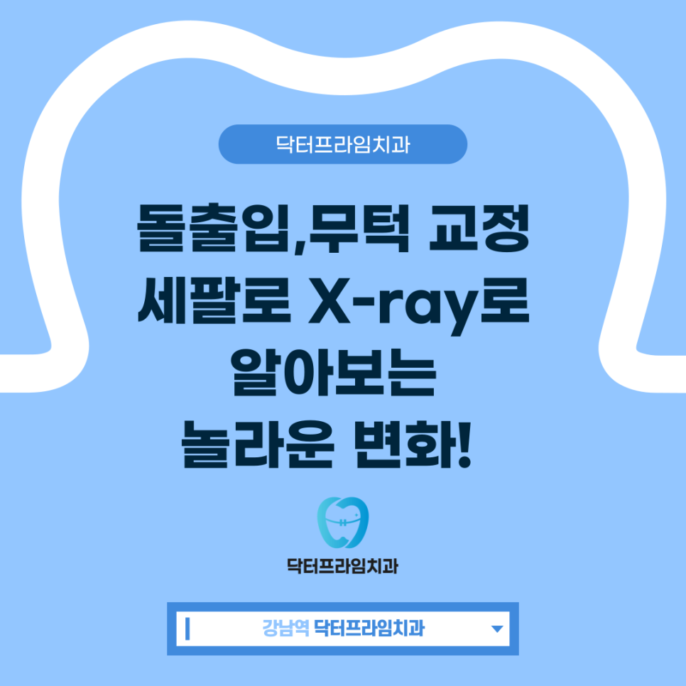 돌출입, 무턱 교정!    세팔로 X-ray로 알아보는 놀라운 변화! 관련 이미지 1
