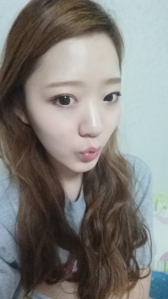 [치아교정후기] 앞니돌출교정후기(16) 관련 이미지 3