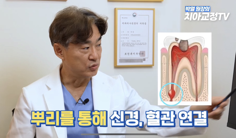 강남역치아교정, 신경치료 받은 치아도 교정이 될까? 관련 이미지 7