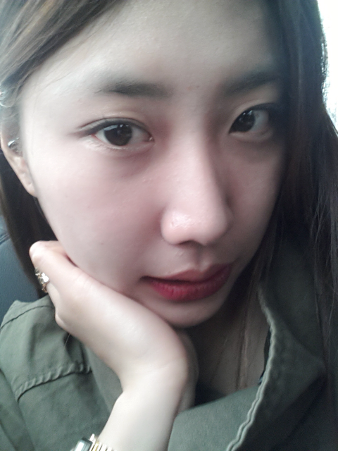 [치아교정후기] 덧니교정후기(2) 관련 이미지 5