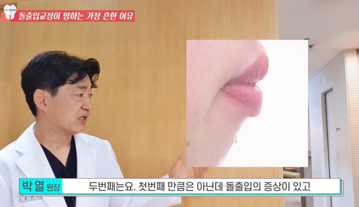 돌출입 교정치과 옥니 돌출입 치아 교정 왜 망할까? 관련 이미지 11