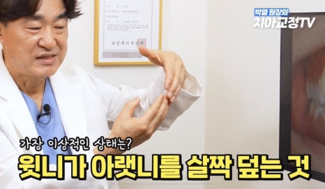닥터프라임치과 성인 치아 교정 장점은? 관련 이미지 15