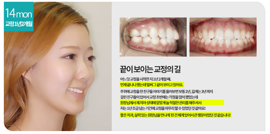 교정첫방문 두근두근, 콩닥콩닥 관련 이미지 6