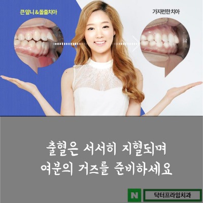 돌출입 교정 중 발치교정 과정 알아보기! 관련 이미지 4
