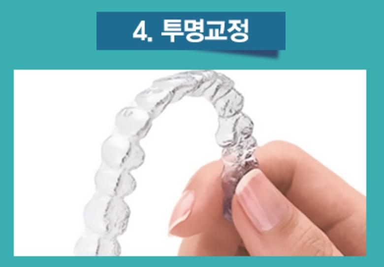 치아교정의 종류 4가지 1) 세라믹교정 2) 클리피시교정 3)설측교정 4) 투명교정 관련 이미지 4
