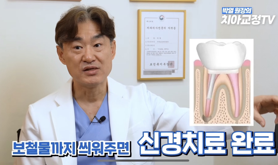 강남역치아교정, 신경치료 받은 치아도 교정이 될까? 관련 이미지 10