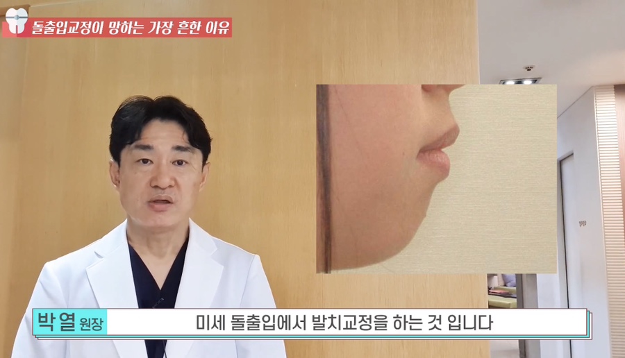 돌출입 교정치과 옥니 돌출입 치아 교정 왜 망할까? 관련 이미지 16