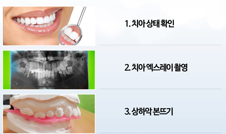 [치아교정] 치아교정검사. 돌출입, 덧니, 안면비대칭등 다양한 부정교합의 교정전후비교도 가능합니다! 관련 이미지 1