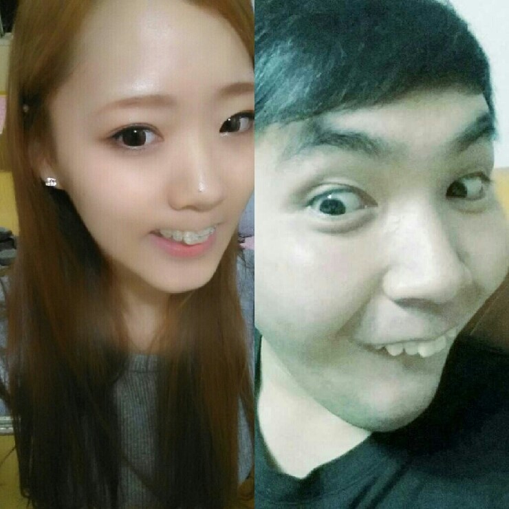 [치아교정 후기] 앞니 돌출교정 후기(2) 관련 이미지 3
