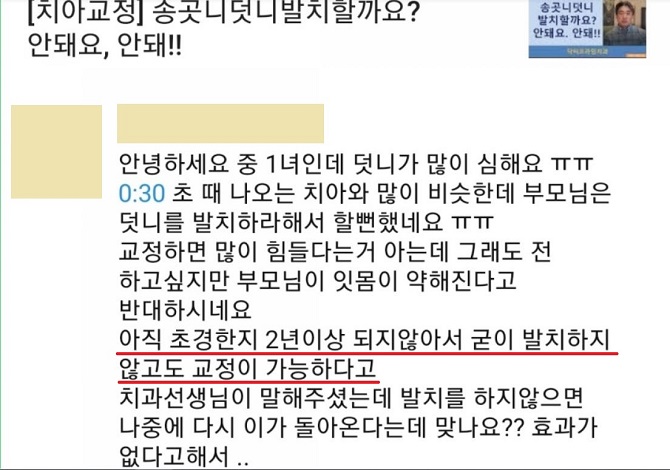 중학생덧니교정이 필요한 이유 3가지! 관련 이미지 8