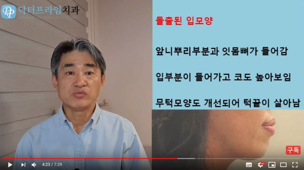 얼굴이 이뻐지는 치아교정! (덧니, 비대칭, 돌출입) 관련 이미지 9