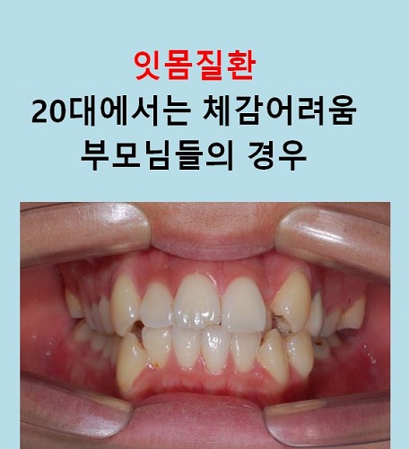 교정만으로 개선가능한 안면비대칭 알아보기(닥터프라임치과) 관련 이미지 9