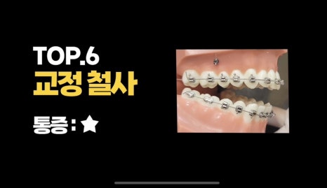 Worried About Orthodontic Pain? The Most Painful Moments During Orthodontic Treatment: Top 7 Pain Ranking image 8
