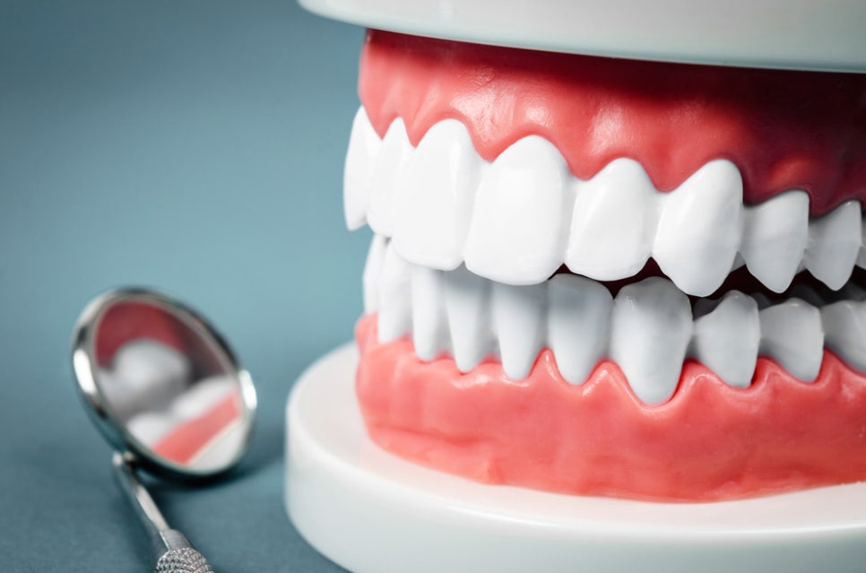 Braces Review from a Female Patient in Her 30s: If You're Looking for Orthodontic Treatment Near Gangnam Station image 2