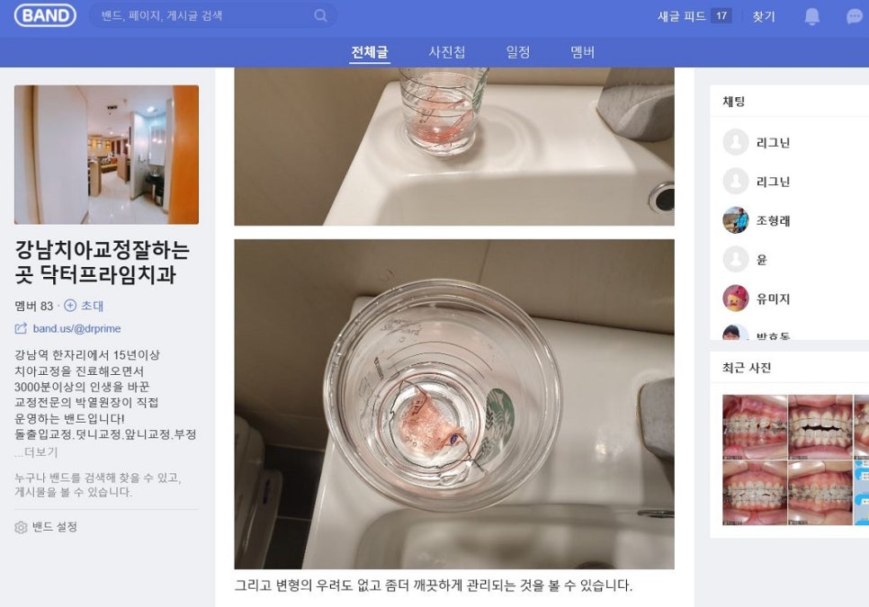 치아교정기간중 알아야 할 100가지! 관련 이미지 6