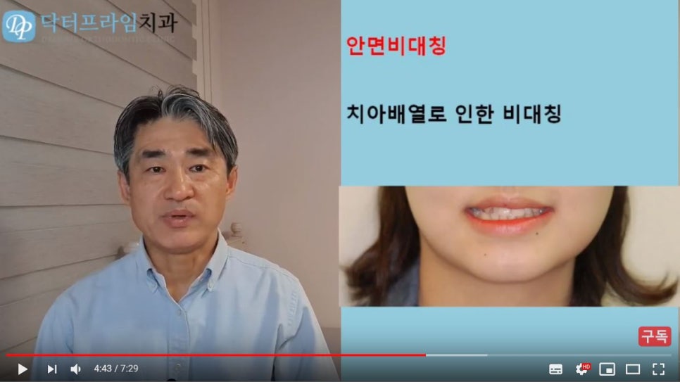 얼굴이 이뻐지는 치아교정! (덧니, 비대칭, 돌출입) 관련 이미지 11