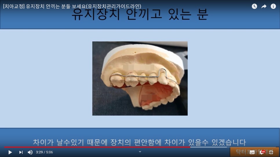 [치아교정] 유지장치 안끼고 있는 분들은 꼭 보세요!! 관련 이미지 5