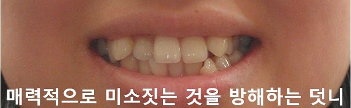 매력적으로 미소짓는 법! 관련 이미지 5