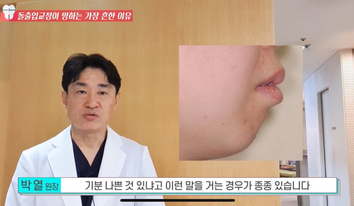 돌출입 교정치과 옥니 돌출입 치아 교정 왜 망할까? 관련 이미지 3
