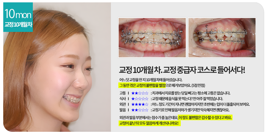 교정첫방문 두근두근, 콩닥콩닥 관련 이미지 5
