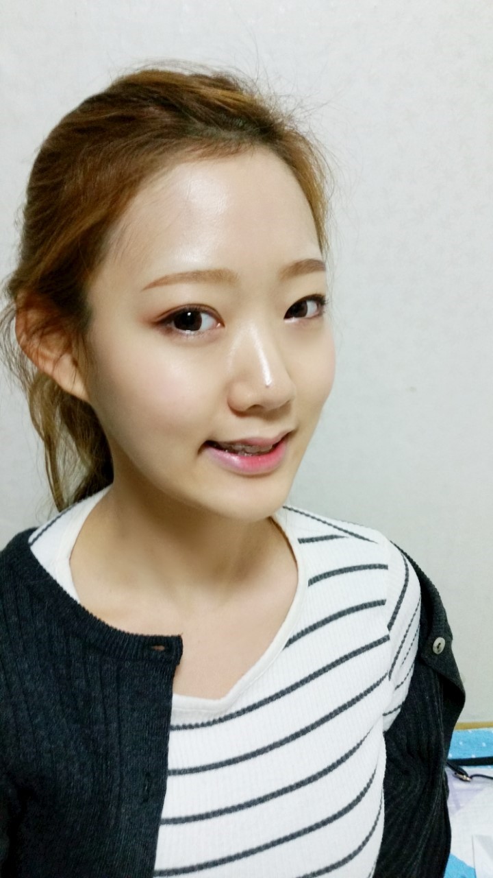 [치아교정후기] 앞니돌출교정후기(15) 관련 이미지 3