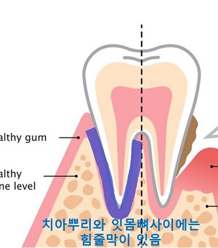 교정시작을 망설이게 하는 치아교정통증(1) 관련 이미지 3