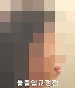 돌출입교정에 성공하는 방법 3가지! 관련 이미지 6