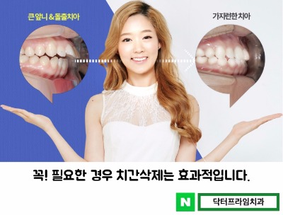 치아교정 치간삭제 관련하여&hellip; 관련 이미지 2
