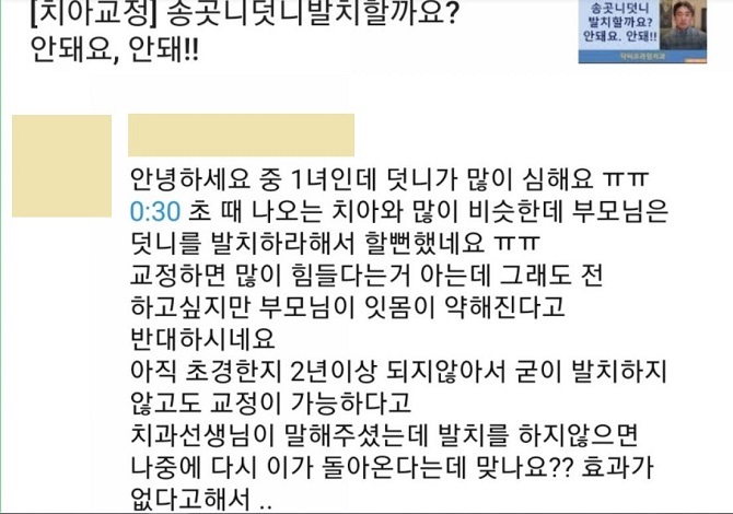중학생덧니교정이 필요한 이유 3가지! 관련 이미지 4