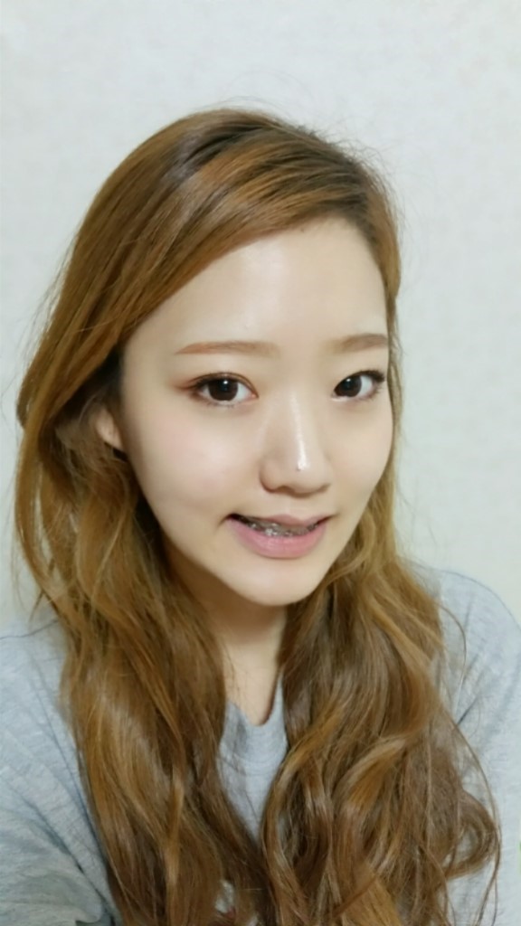 [치아교정후기] 앞니돌출교정후기(16) 관련 이미지 2