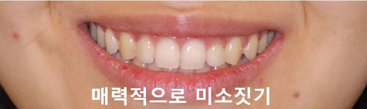 매력적으로 미소짓는 법! 관련 이미지 3
