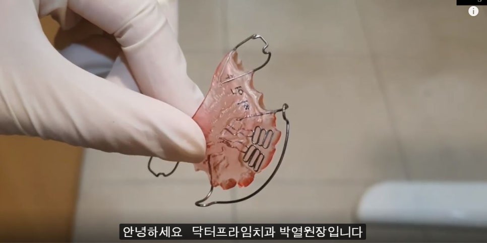 [치아교정] 소아교정=1차교정=턱교정. 비슷한 개념입니다 관련 이미지 1